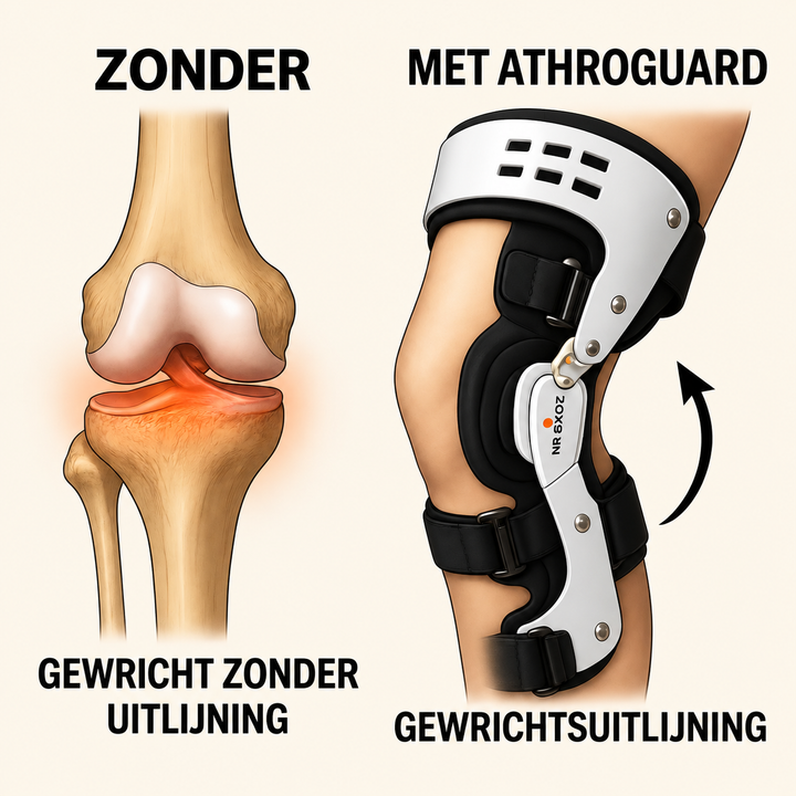 Anatomische vergelijking van een kniegewricht met en zonder ondersteuning van een brace.