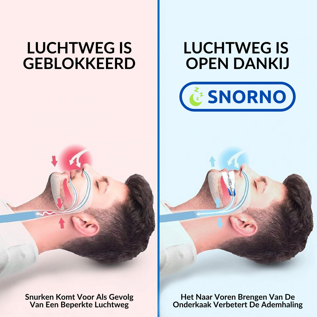 Snurkbeugel verbetert ademhaling voor diepere slaap. Einde aan onrustige nachten door snurken.