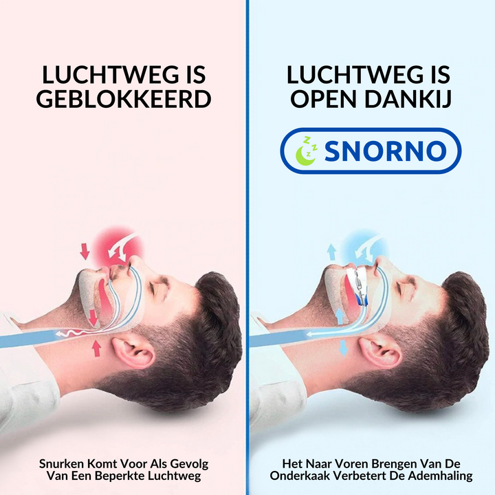 Snurkbeugel verbetert ademhaling voor diepere slaap. Einde aan onrustige nachten door snurken.
