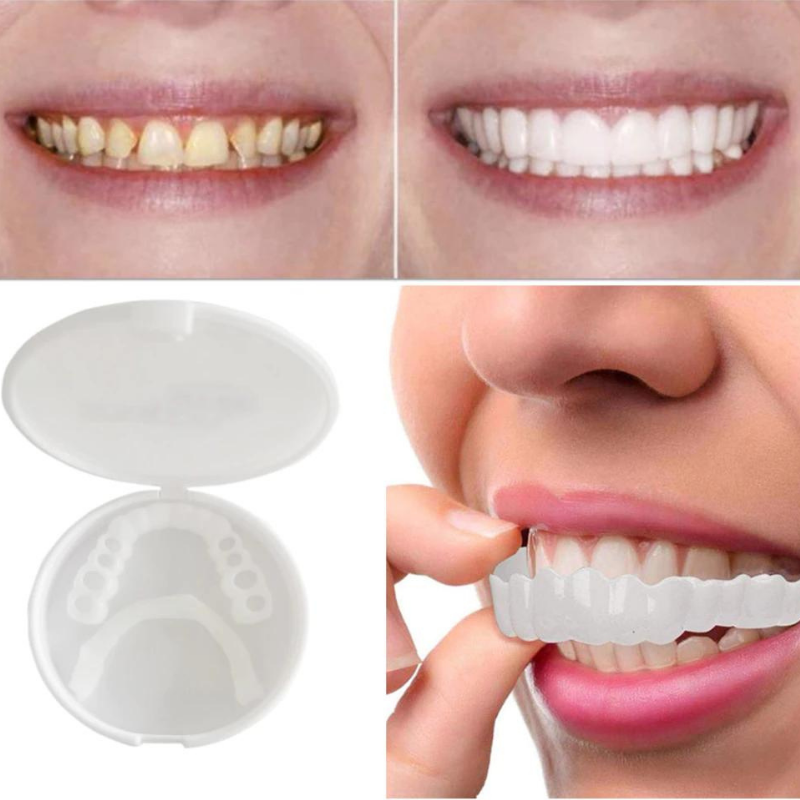 Close-up van ClearSmile EasyClick kunstgebit, toont innovatieve bevestiging voor comfort en een stralende lach.
