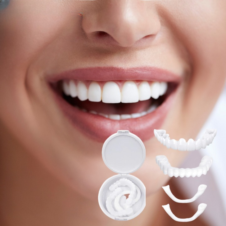Model glimlacht breed met ClearSmile EasyClick tijdelijke tanden, een cosmetische oplossing voor een perfect gebit.
