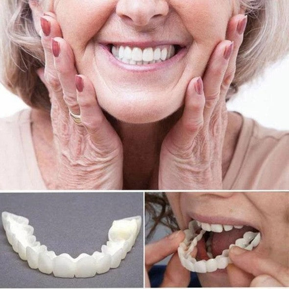 Cosmetische veneers voor een stralende, zelfverzekerde glimlach. Geschikt voor zowel boven- als onderkaak.