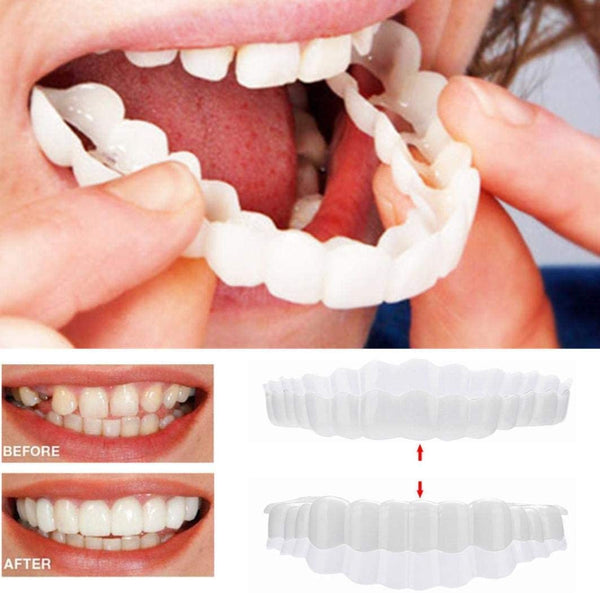 Unisex tanden veneers, perfect passend op het gebit voor een natuurlijke esthetische tandcorrectie.