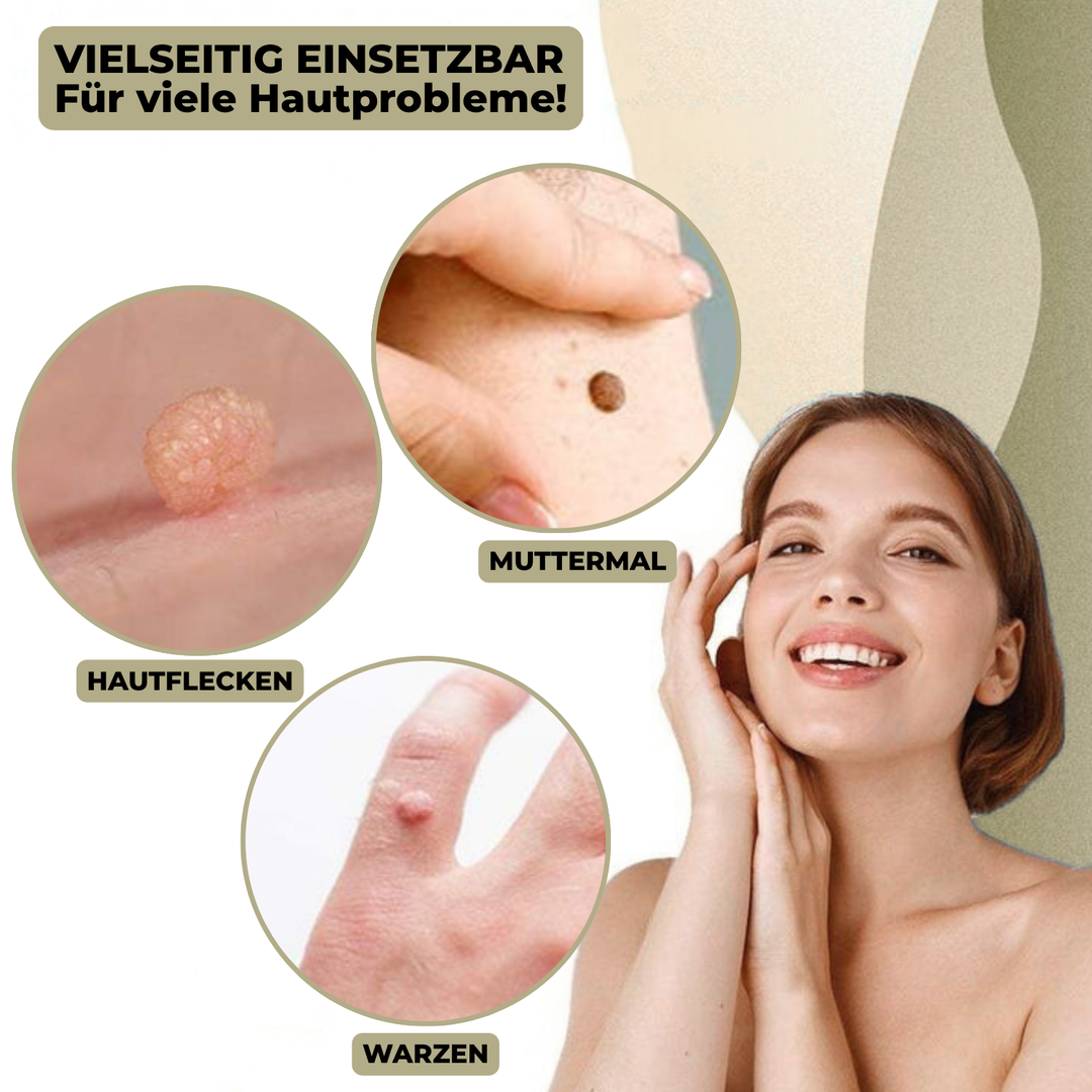 Pijnloze cosmetische wrattenverwijderaar voor thuis. Voor een egale en vernieuwde huid zonder vlekken.