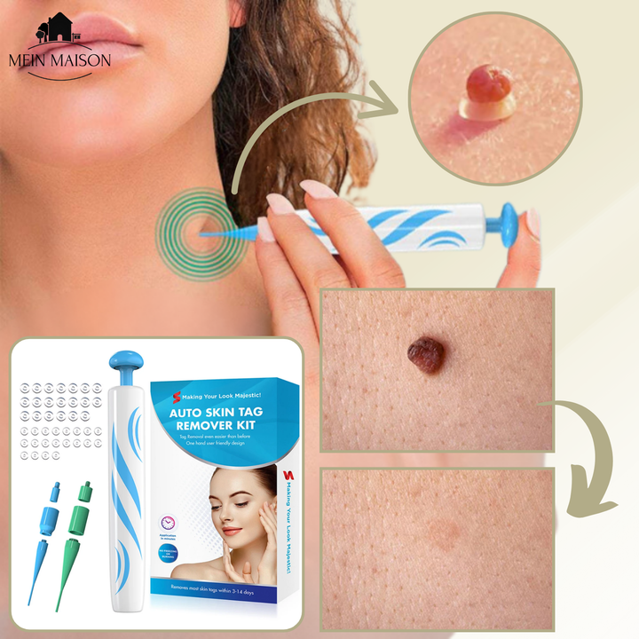 Huidvernieuwing met onze cosmetische wratten & moedervlekken verwijderaar. Pijnloos en effectief thuis.