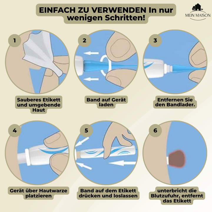 Voor een vlekkeloze schoonheid: pijnloze cosmetische wratten- en moedervlekkenverwijderaar voor thuis.