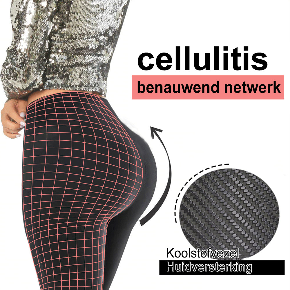 Elegante zwarte SculptFit dameslegging met compressietechnologie tegen cellulitis, ideaal voor fitness en shaping.