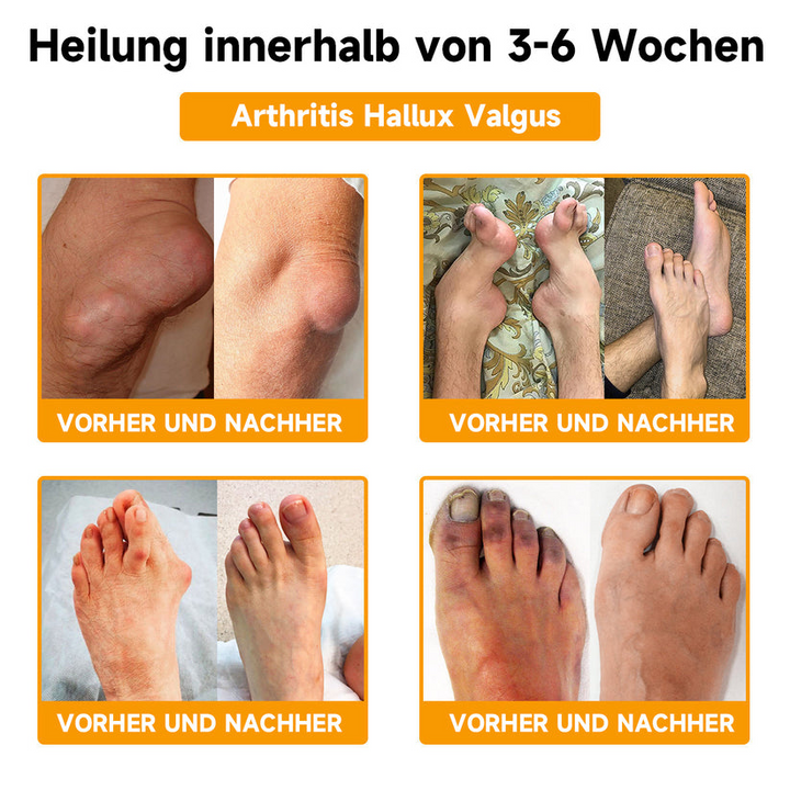 Unisex verzachtende bijengifcrème met hyaluron en collageen in pot