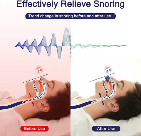 Ergonomisch anti-snurk micro CPAP-apparaat voor comfortabele ademhalingstherapie, draagbaar voor thuis en op reis.