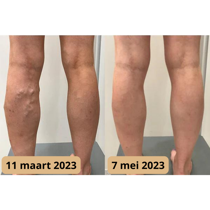 Lymfomat mat voor diepe voetmassage, met focus op lymfedrainage en algemene gezondheid.