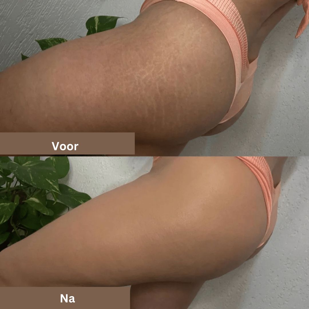 Waterdichte concealer voor vrouwen; camoufleert vlekken, littekens en tatoeages op gezicht en lichaam perfect.
