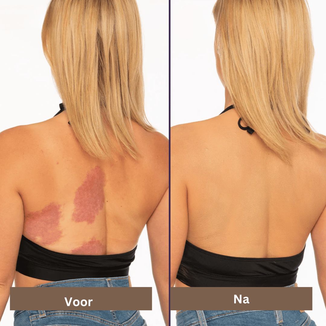 Vrouwen waterdichte concealer zorgt voor een natuurlijke, vlekkeloze huid en verbergt onvolkomenheden effectief.