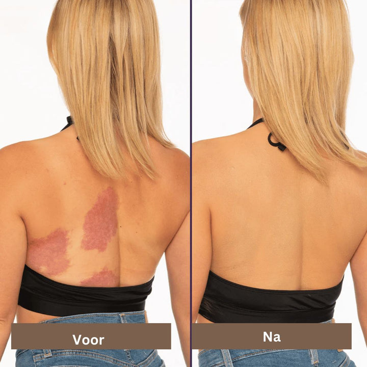 Vrouwen waterdichte concealer zorgt voor een natuurlijke, vlekkeloze huid en verbergt onvolkomenheden effectief.