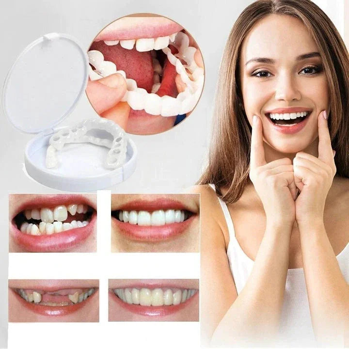 Perfecte witte Snap-On Tanden Veneers die direct zelfvertrouwen geven; voor een stralende, cosmetische glimlach.