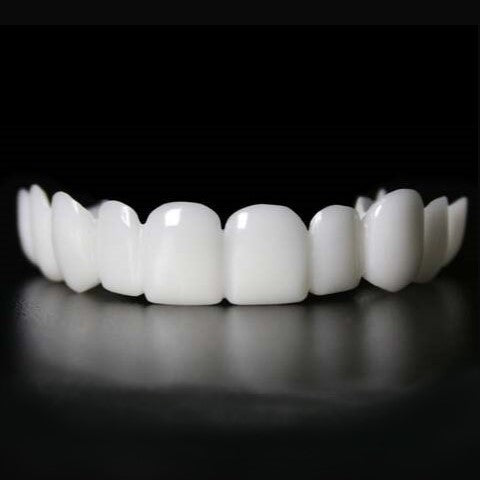 Herbruikbare Snap-On Tanden Veneers; een betaalbare en snelle tandprothese voor een mooi gebit.