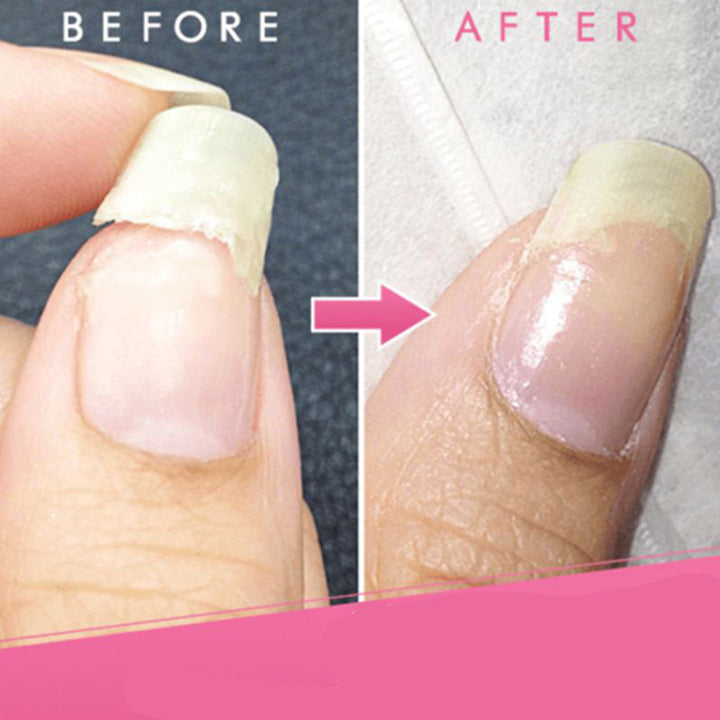 Dame brengt AlisaNails nagel reparatie gel aan voor sterke, gezonde nagels en manicure thuis.