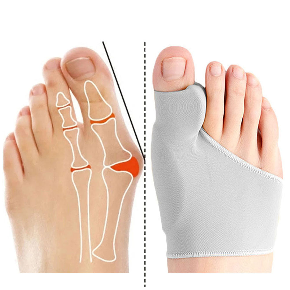 Zachte gelpad teen corrector voor hallux valgus, biedt direct comfort bij bunion en voetpijn.