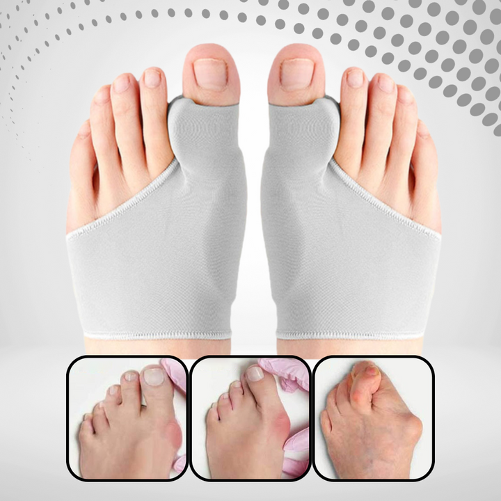Flexibele hallux valgus beugel met gelpad, unisex ontwerp voor dagelijkse voetpijnvermindering & correctie.