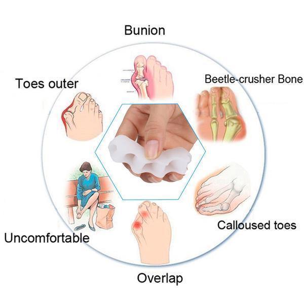 Teen corrector voor hallux valgus en hamertenen, helpt bij voetklachten. Biedt comfort en orthopedische ondersteuning.