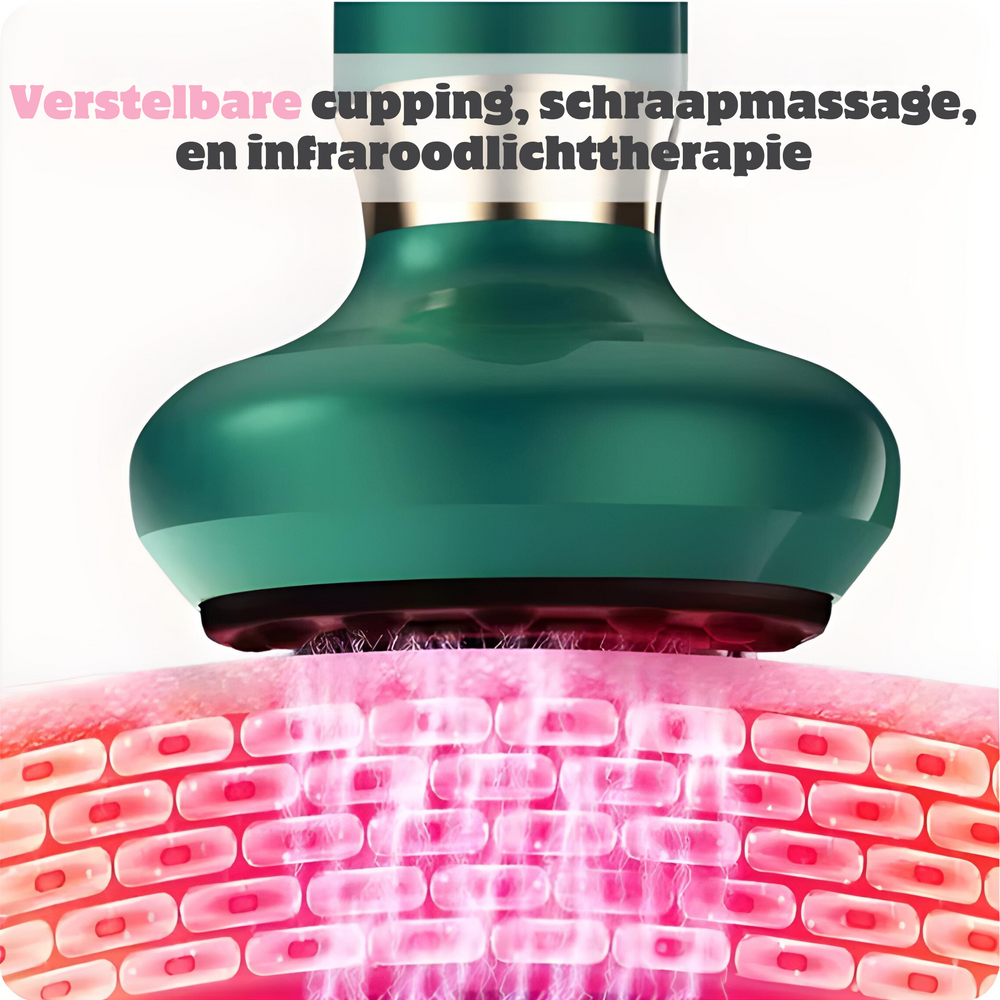 SlimCupp cupping apparaat met infraroodtherapie voor effectieve cellulitisreductie en huidversteviging.