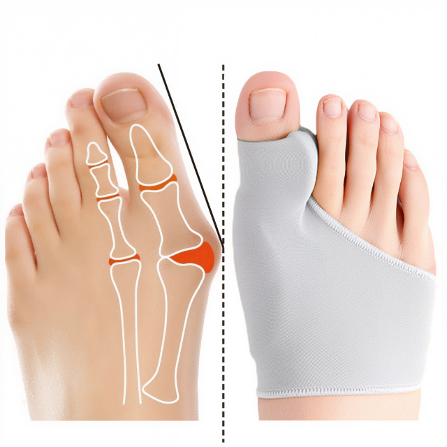Unisex bunion corrector gelpad, ideaal voor dagelijkse voetverzorging en verlichting van voetpijn.