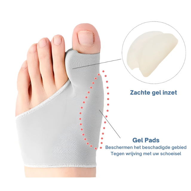 Orthopedische bunion corrector met zachte gelpad voor correctie van hallux valgus en comfort.
