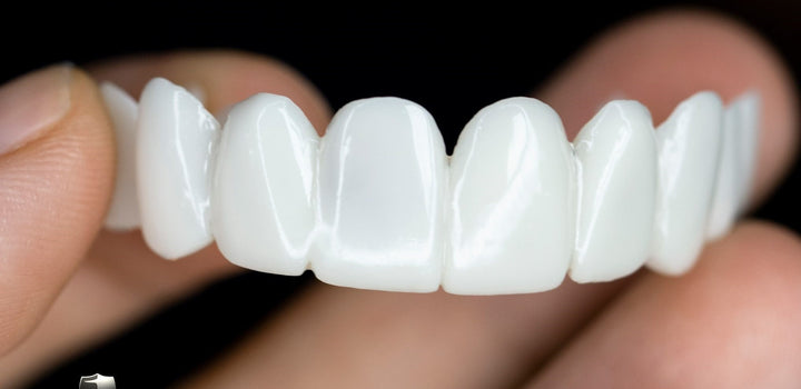 Ergonomisch gevormde tandfacetten voor een perfecte pasvorm en stralende, esthetische tanden.